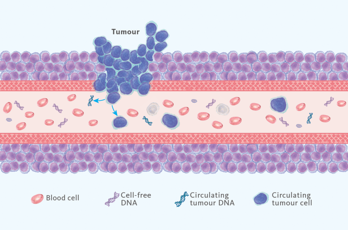 Mi az a liquid biopszia?